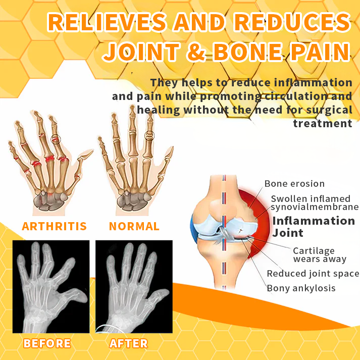 🐝Seurico™ Bee Venom Joint Therapy Pain Relief Gel