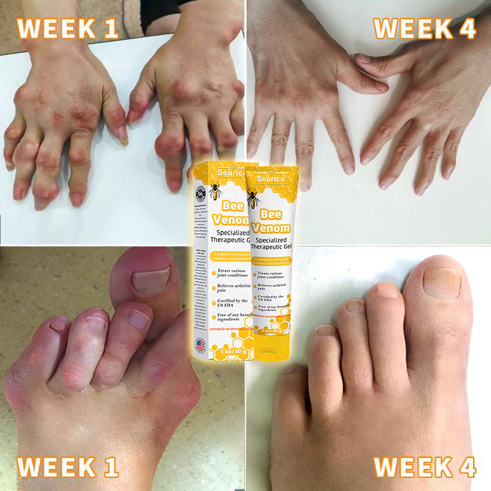 🐝Seurico™ Bee Venom Joint Therapy Pain Relief Gel